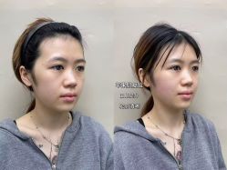 -素美医疗美容·西南眼鼻整形·修复基地