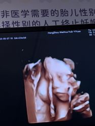 -杭州贝瑞斯美华妇儿医院·早孕·产检·儿科