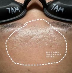 点击看大图 -MLP美丽派·问题肌疗愈中心