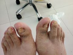 -新甲连锁灰指甲·甲沟炎·鸡眼(黑龙江路店)