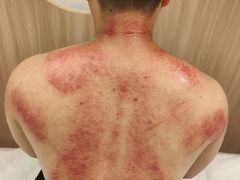 -太乙盲人推拿足疗艾灸连锁(晴川店)