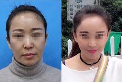 -加减美医美连锁品牌