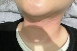 -美安心医美·美迪迈黄金微针·美拉美医疗美容