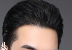 -大麦微针植发丨全国连锁