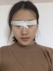 点击看大图 -广东韩妃整形外科医院