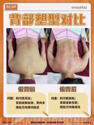 点击看大图 -丽减美瘦吧·减肥瘦身