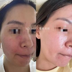 -美愈美肤MEIYU SKIN