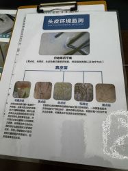 -牛大夫植发