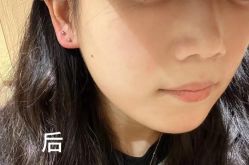 -上海伊莱美医疗美容医院