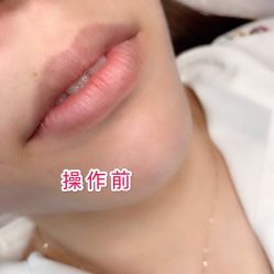 -西施无菌半永久纹绣眉眼影唇轻增发纹发际线
