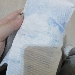 点击看大图 体验后-天津伊美尔医疗整形美容专科医院