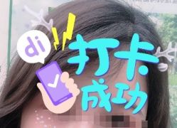 -大麦微针植发全国连锁