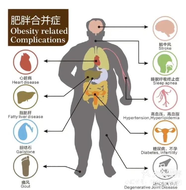 肥胖的危害图片 图解图片