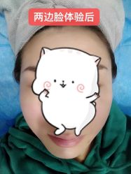 体验后-圣嘉新医疗美容医院