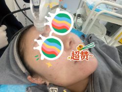 体验后-More摩尔医美の注射线雕光电中心