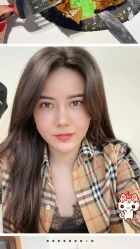 -大麦微针植发丨全国连锁