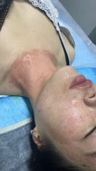 -长沙雅美医疗美容医院