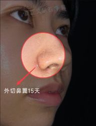 -北京米扬丽格医疗美容·联合丽格鼻整形中心