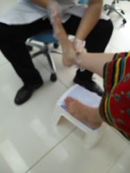 -派恩宜灰指甲鸡眼嵌甲手足癣