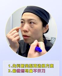 -广州健丽·去眼袋医疗美容机构