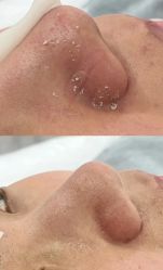 -SKIN79皮肤管理中心
