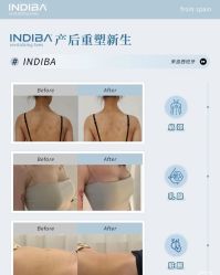 -半岛故事·法儿曼抗衰·indiba中心