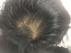 -乌守道白发防脱生发养发