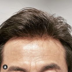 -发饰美男士增发补发假发定制店