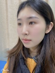 体验后-重庆联合丽格第五医疗美容医院