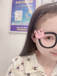 -大麦微针植发全国连锁