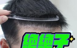 -大麦微针植发丨全国连锁