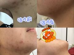 -万达广场(惠州大亚湾店)