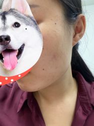 -小忠丽格医美