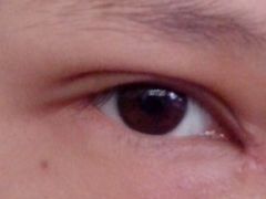 第八天-上海华安整形外科门诊部