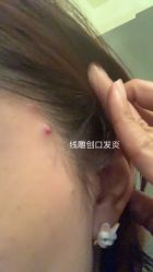 体验前-成都艾特他整形外科医院