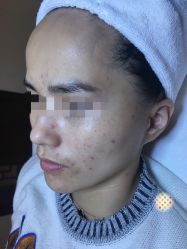 -皇族养心堂·净痘·修敏·御颜