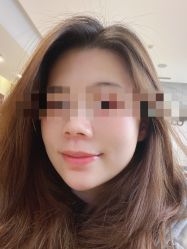 -北京米扬丽格医疗美容·联合丽格鼻整形中心