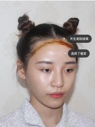 -长沙雅美医疗美容医院