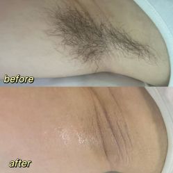 点击看大图 -植蔻妍倍儿专业脱毛·皮肤管理