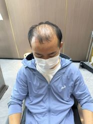-唐风采假发补发定制