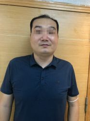 -极客侠男士假发定制补发