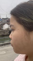 体验前-上海玫瑰医疗美容医院