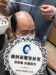 -唐风采假发补发定制