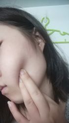 -宜肤清颜专业祛痘问题肌修护