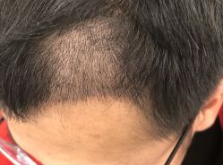 -熙朵美学植发·连锁品牌