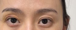 -More摩尔医美の注射线雕光电中心