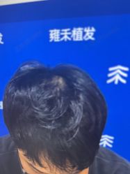 -雍禾植发全国连锁