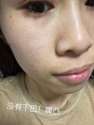 -新美荟医美·专注面部美学抗衰