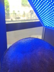 -碧莲盛·不剃发植发