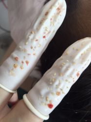 -宜肤清颜专业祛痘问题肌修护